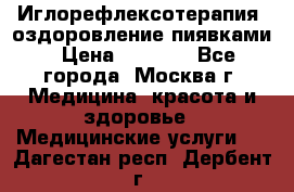 Иглорефлексотерапия, оздоровление пиявками › Цена ­ 3 000 - Все города, Москва г. Медицина, красота и здоровье » Медицинские услуги   . Дагестан респ.,Дербент г.